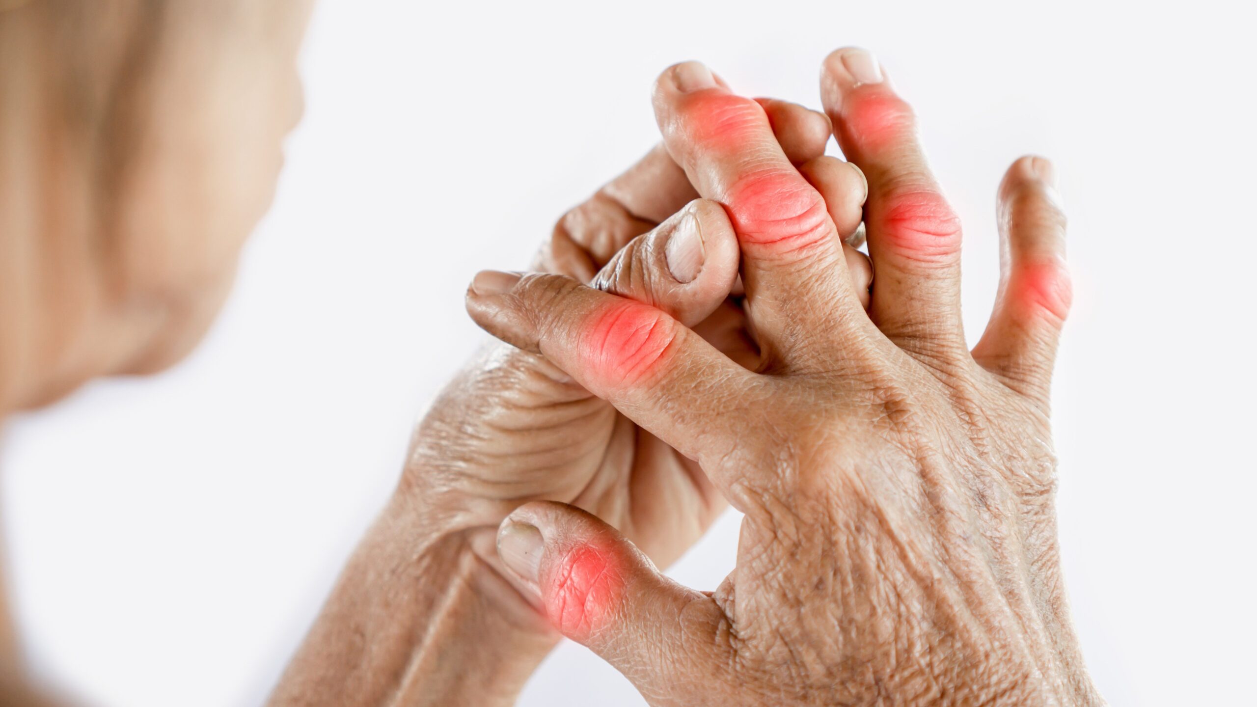rheumatoid arthritis joint pain f716ef1d44